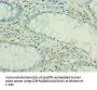 IL36RN Antibody