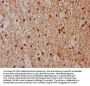 CPNE7 Antibody