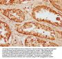 CLN8 Antibody