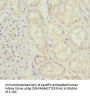 INPP5K Antibody