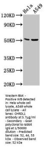 CHRDL1 Antibody