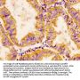 CHRDL1 Antibody