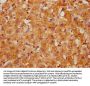 CCDC28B Antibody
