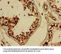 BRIP1 Antibody