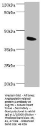 Rabbit anti-human Angiopoietin-related protein 4 polyclonal Antibody(ANGPTL4 )