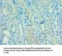 Rabbit anti-human Angiopoietin-related protein 4 polyclonal Antibody(ANGPTL4 )