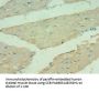 Rabbit anti-human Angiopoietin-related protein 4 polyclonal Antibody(ANGPTL4 )