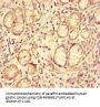 ACE2 Antibody