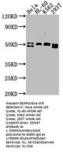 DDX47 Antibody
