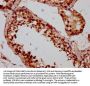 BOLA2 Antibody