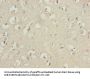 TUBB1 Antibody