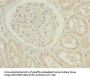 TUBB1 Antibody