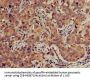 TFB2M Antibody
