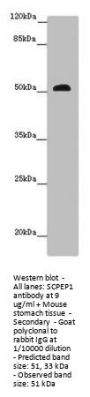 SCPEP1 Antibody