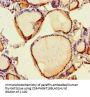 SCPEP1 Antibody