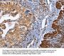 PTPRC Antibody
