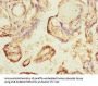 GCM1 Antibody