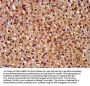 PNPLA8 Antibody
