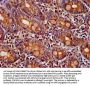 PNPLA8 Antibody