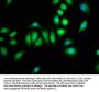 PNPLA8 Antibody