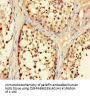 TRIM36 Antibody