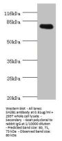 SH2B1 Antibody