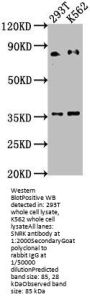 SNRK Antibody