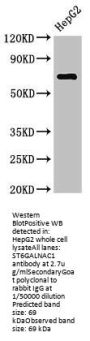 ST6GALNAC1 Antibody