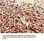 ST6GALNAC1 Antibody