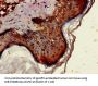 ST6GALNAC1 Antibody