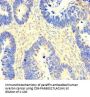 SACM1L Antibody