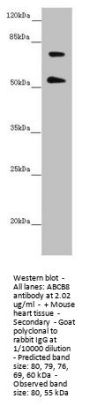 ABCB8 Antibody