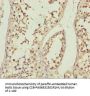 ABCB8 Antibody
