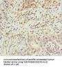 ABCB8 Antibody