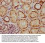 GRHL1 Antibody