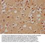 GRHL1 Antibody