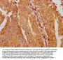 RAI14 Antibody