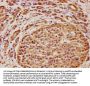 C5AR2 Antibody