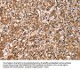 HTR3C Antibody