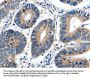 CDKN1B Antibody