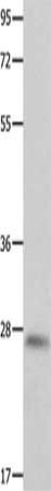 CDKN1B Antibody