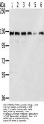 RNF20 Antibody