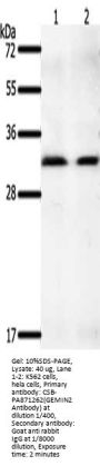 GEMIN2 Antibody