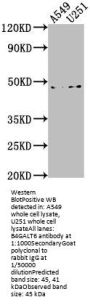 B4GALT6 Antibody