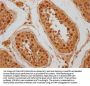 DAXX Antibody