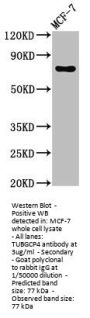 TUBGCP4 Antibody