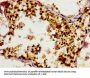 TUBGCP4 Antibody