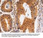 CDK6 Antibody
