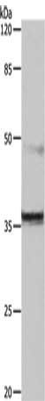 CDK6 Antibody