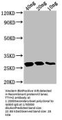 TTYH2 Antibody